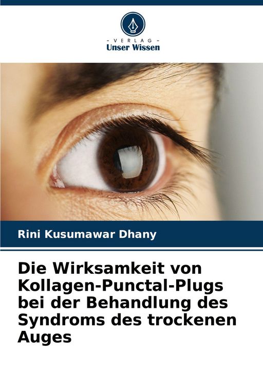 Produktbild: Die Wirksamkeit von Kollagen-Punctal-Plugs bei der Behandlung des Syndroms des trockenen Auges
