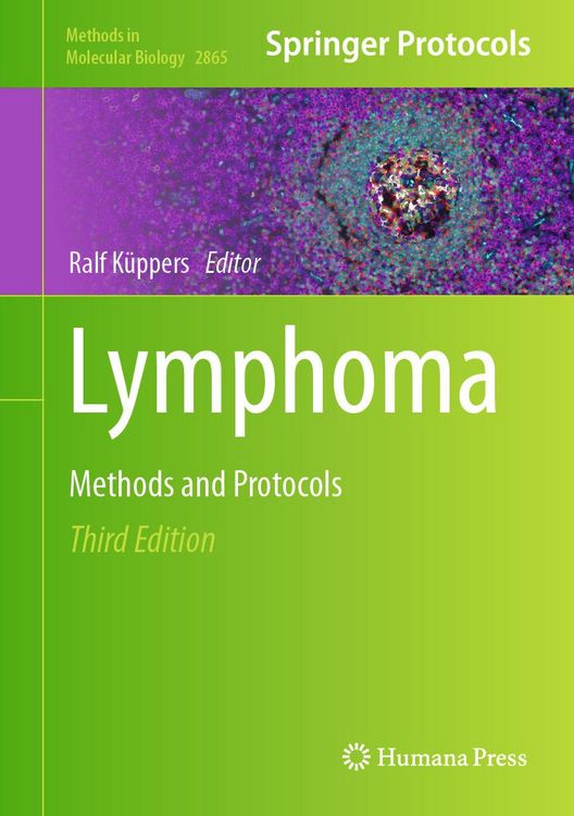 Produktbild: Lymphoma