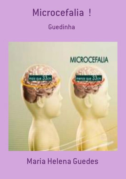 Produktbild: Microcefalia !