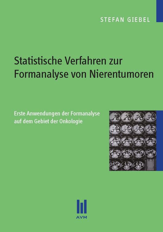 Produktbild: Statistische Verfahren zur Formanalyse von Nierentumoren