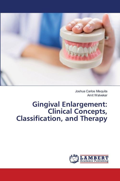 Produktbild: Gingival Enlargement: Clinical Concepts, Classification, and Therapy
