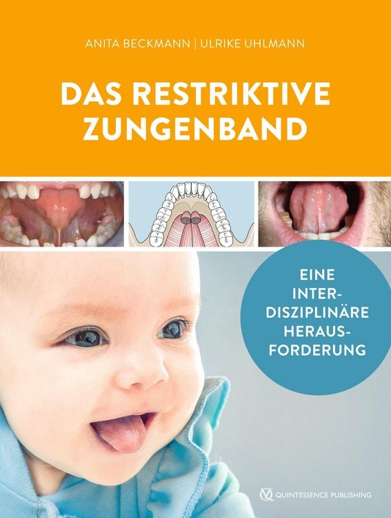 Produktbild: Das restriktive Zungenband