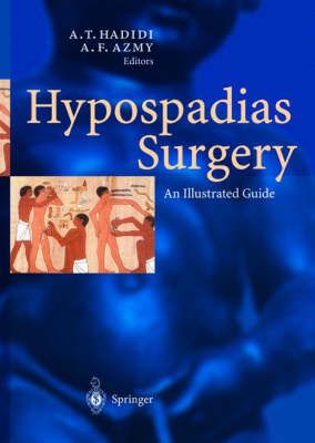 Produktbild: Hypospadias Surgery