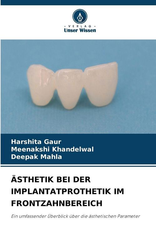 Produktbild: &Auml;sthetik bei der Implantatprothetik im Frontzahnbereich