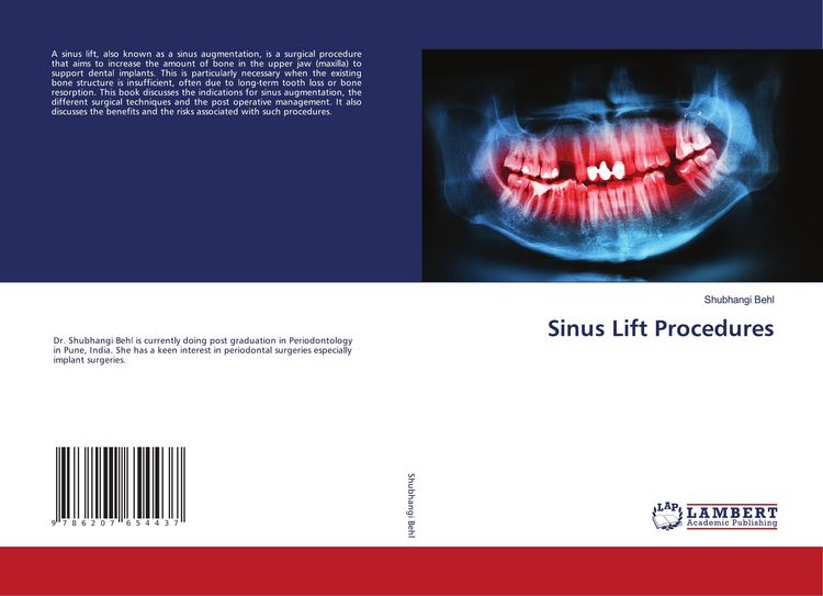 Produktbild: Sinus Lift Procedures