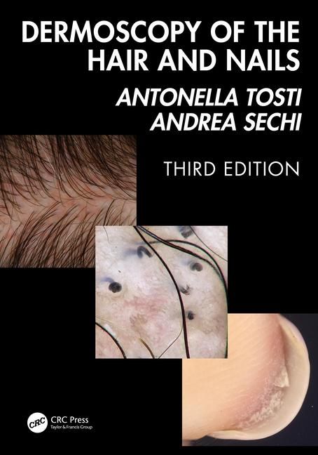 Produktbild: Dermoscopy of the Hair and Nails 3e