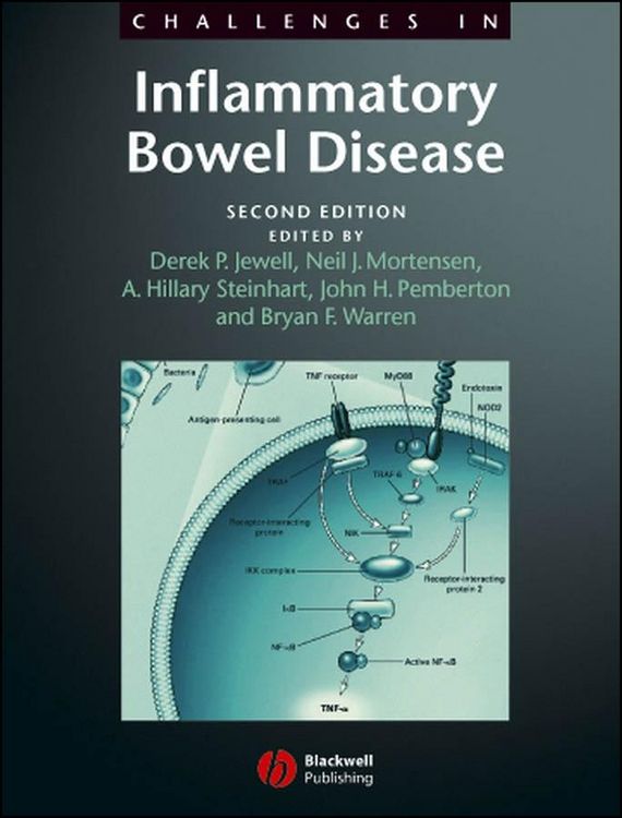 Produktbild: Challenges in Inflammatory Bowel Disease