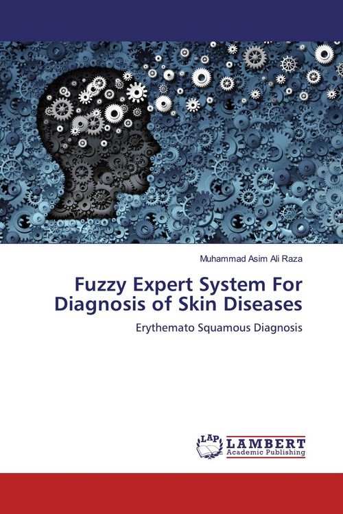 Produktbild: Fuzzy Expert System For Diagnosis of Skin Diseases