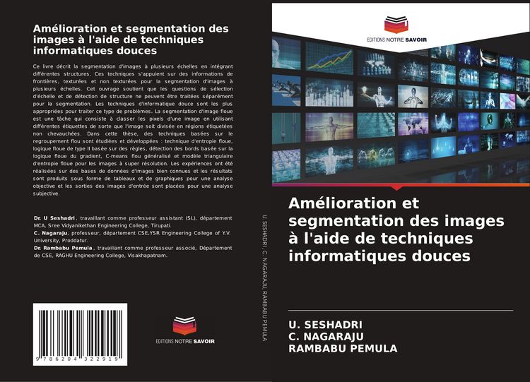 Produktbild: Am&eacute;lioration et segmentation des images &agrave; l'aide de techniques informatiques douces