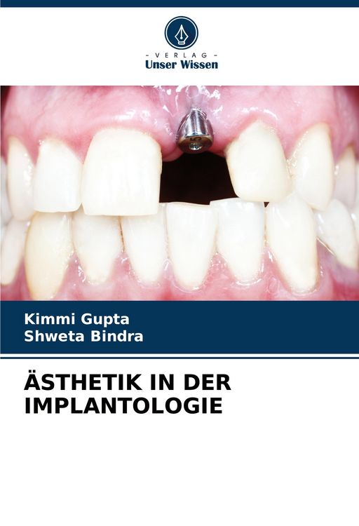 Produktbild: &Auml;sthetik in der Implantologie