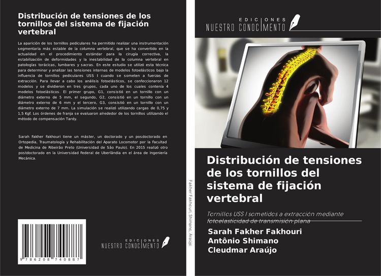 Produktbild: Distribuci&oacute;n de tensiones de los tornillos del sistema de fijaci&oacute;n vertebral