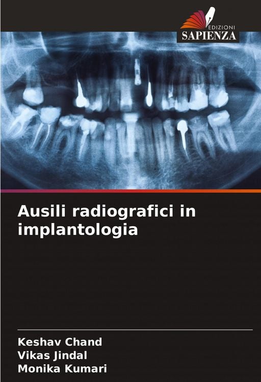 Produktbild: Ausili radiografici in implantologia