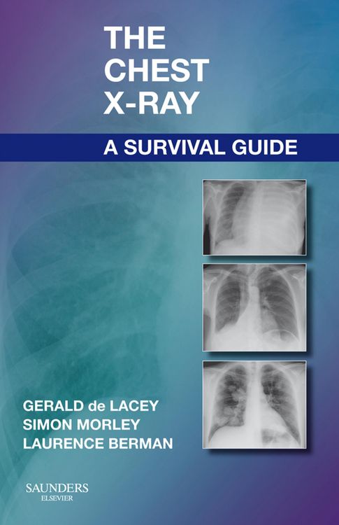 Produktbild: The Chest X-Ray: A Survival Guide