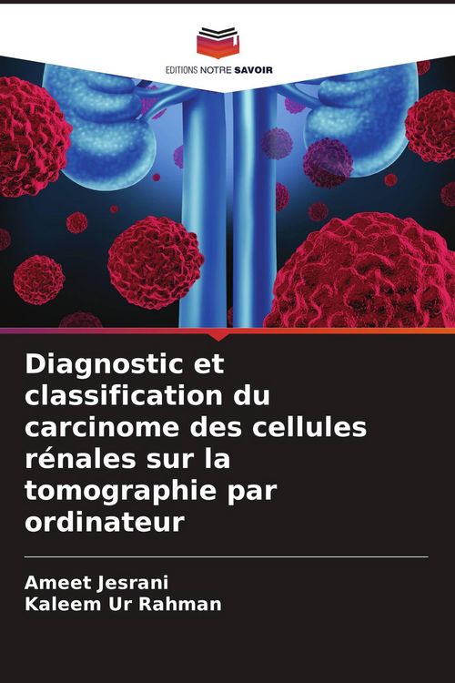 Produktbild: Diagnostic et classification du carcinome des cellules r&eacute;nales sur la tomographie par ordinateur