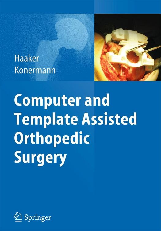 Produktbild: Computer and Template Assisted Orthopedic Surgery