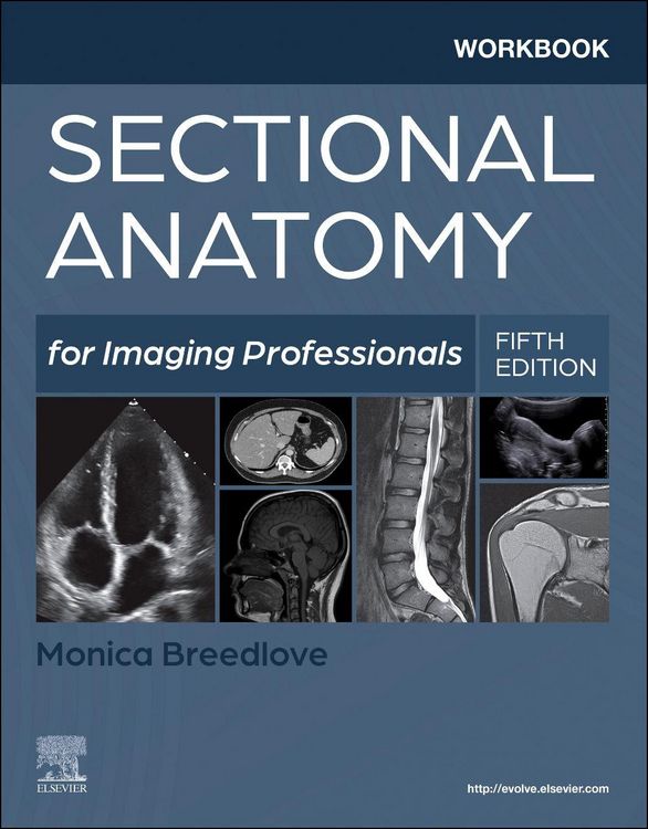 Produktbild: Workbook for Sectional Anatomy for Imaging Professionals