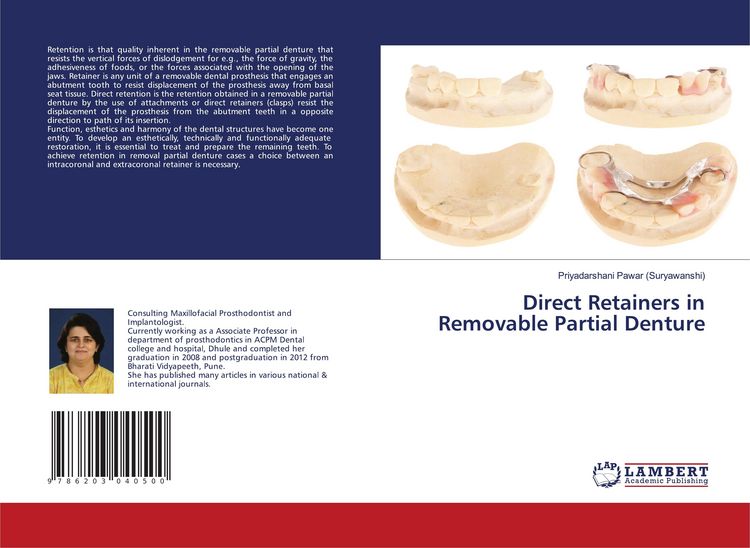 Produktbild: Direct Retainers in Removable Partial Denture