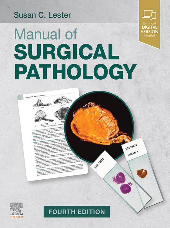 Produktbild: Manual of Surgical Pathology - E-Book