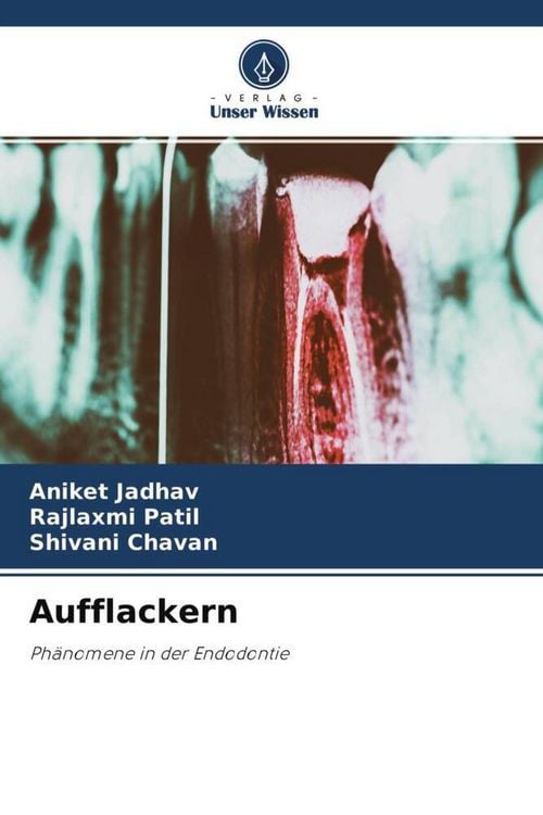 Produktbild: Aufflackern