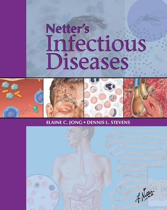 Produktbild: Netter's Infectious Diseases E-Book
