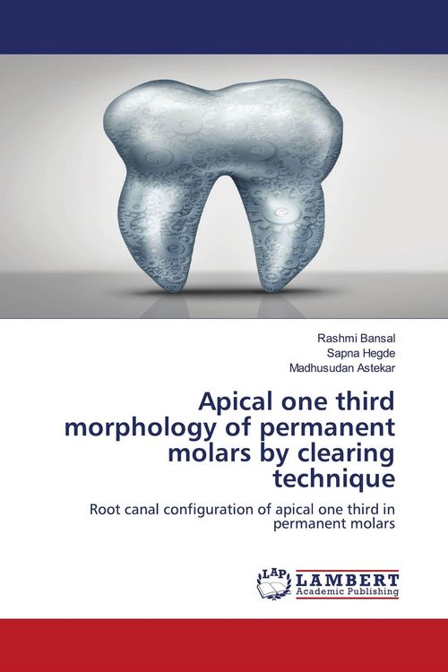Produktbild: Apical one third morphology of permanent molars by clearing technique