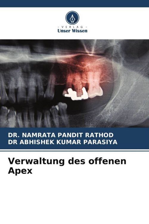 Produktbild: Verwaltung des offenen Apex