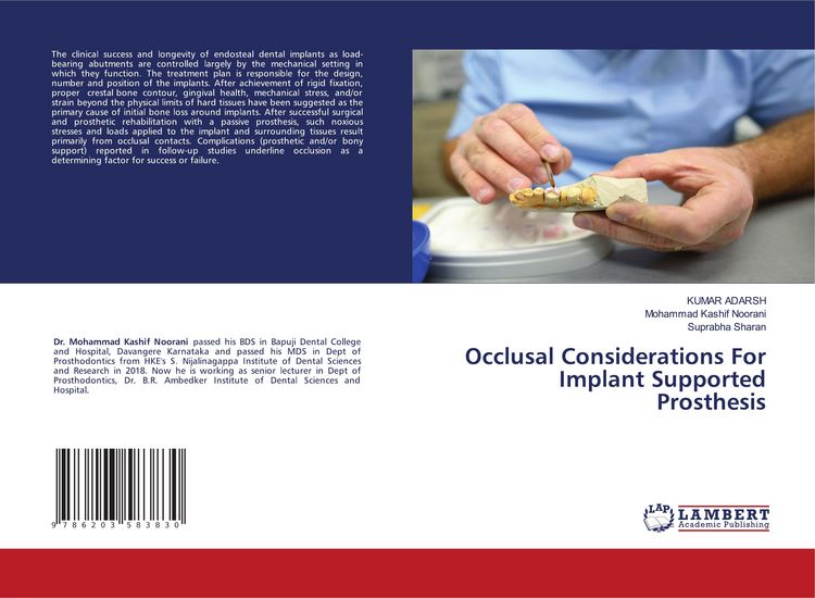 Produktbild: Occlusal Considerations For Implant Supported Prosthesis