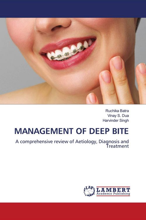 Produktbild: Management Of Deep Bite