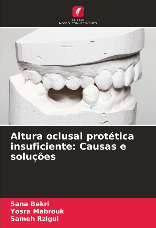 Produktbild: Altura oclusal prot&eacute;tica insuficiente: Causas e solu&ccedil;&otilde;es