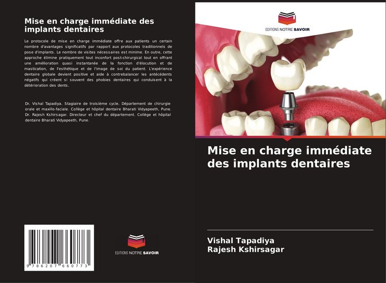 Produktbild: Mise en charge imm&eacute;diate des implants dentaires
