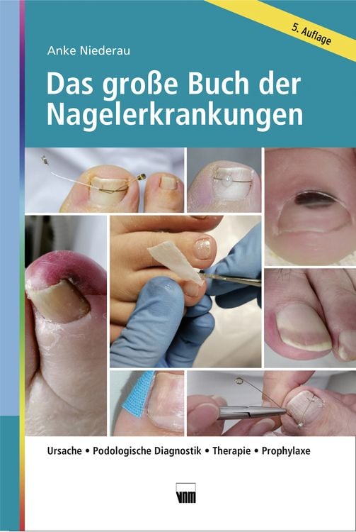 Produktbild: Das gro&szlig;e Buch der Nagelerkrankungen