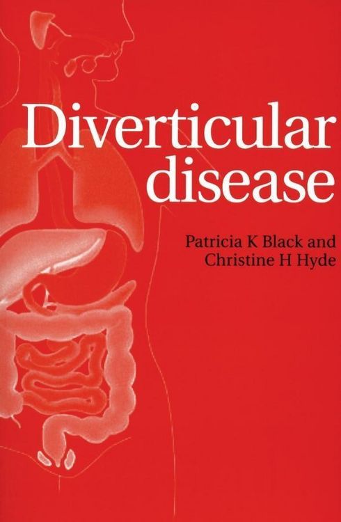 Produktbild: Diverticular Disease