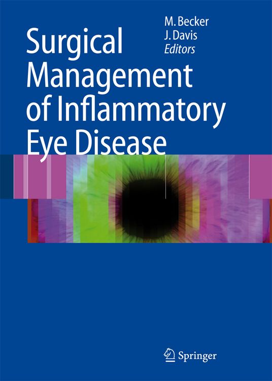 Produktbild: Surgical Management of Inflammatory Eye Disease