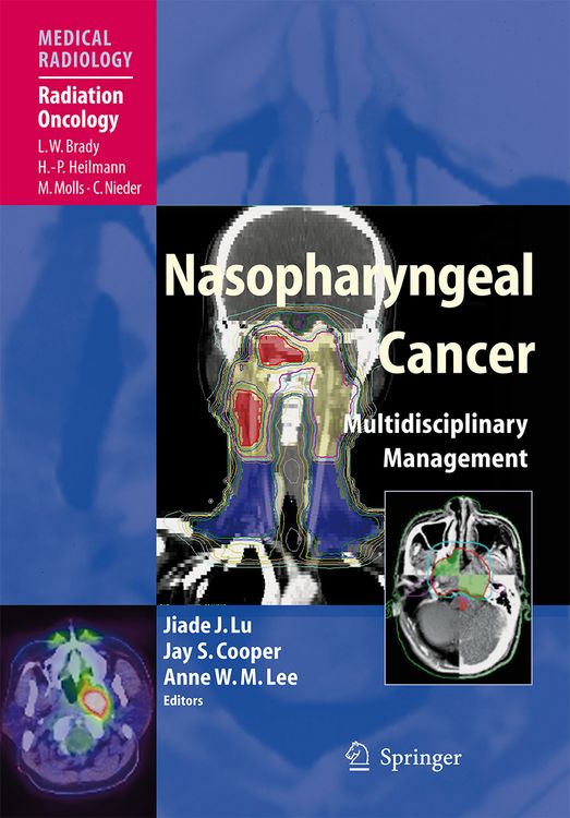 Produktbild: Nasopharyngeal Cancer