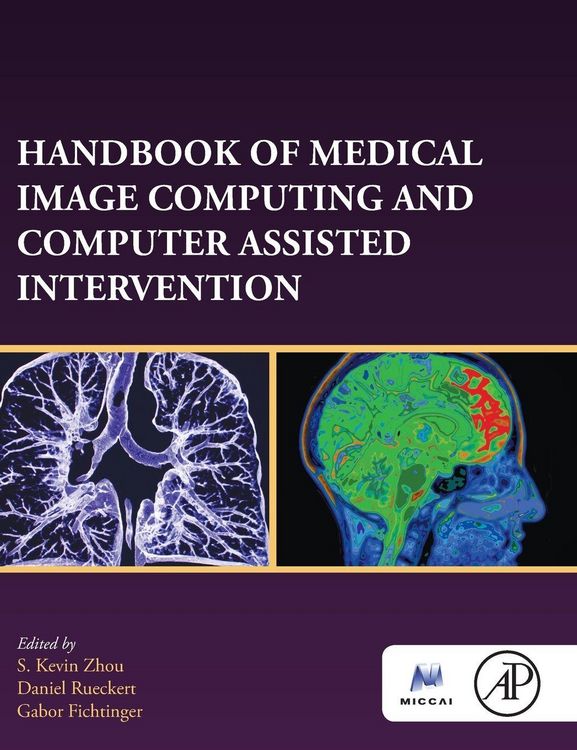 Produktbild: Handbook of Medical Image Computing and Computer Assisted Intervention