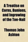 Produktbild: A Treatise on Corns, Bunions, and Ingrowing of the Toe-Nail