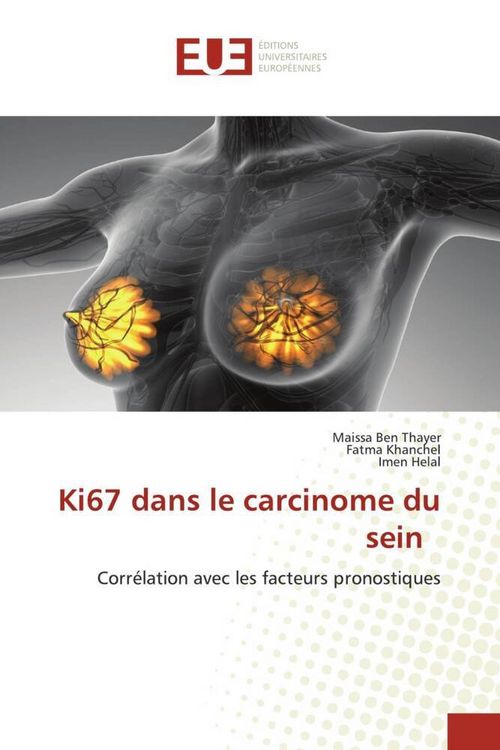 Produktbild: Ki67 dans le carcinome du sein
