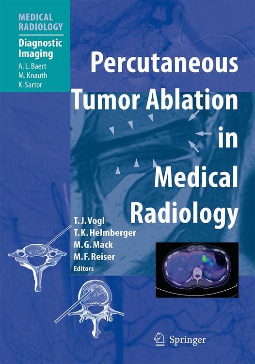 Produktbild: Percutaneous Tumor Ablation in Medical Radiology