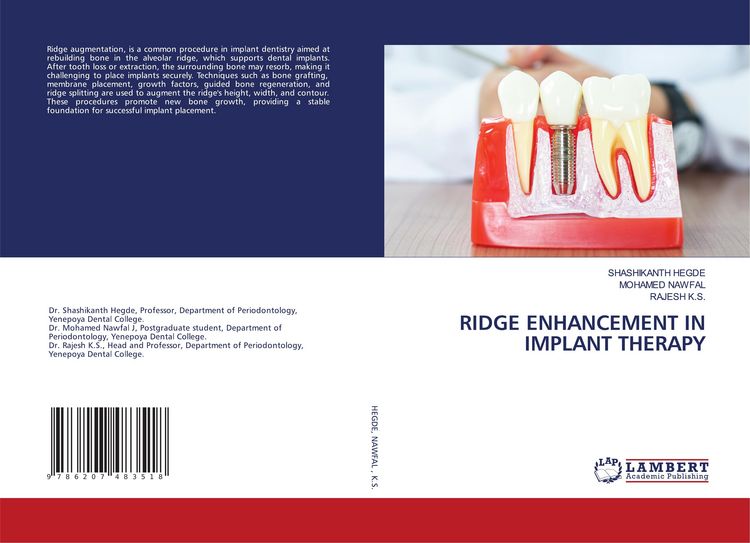 Produktbild: Ridge Enhancement in Implant Therapy