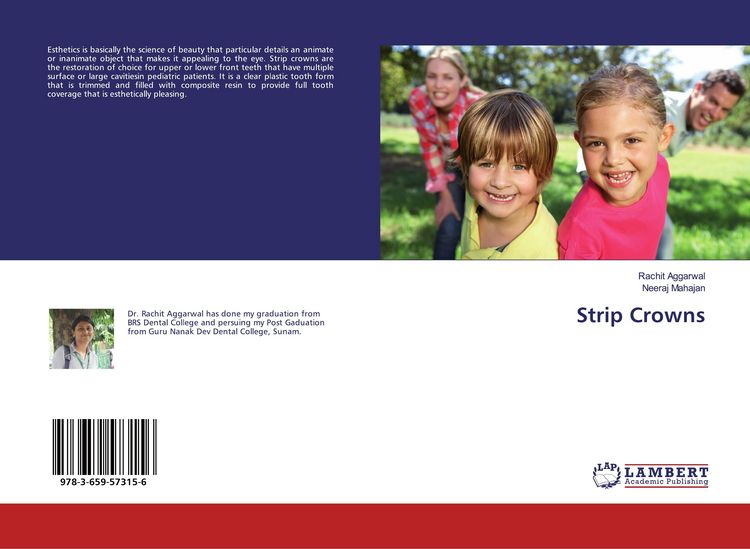 Produktbild: Strip Crowns