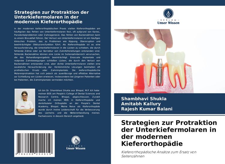 Produktbild: Strategien zur Protraktion der Unterkiefermolaren in der modernen Kieferorthop&auml;die