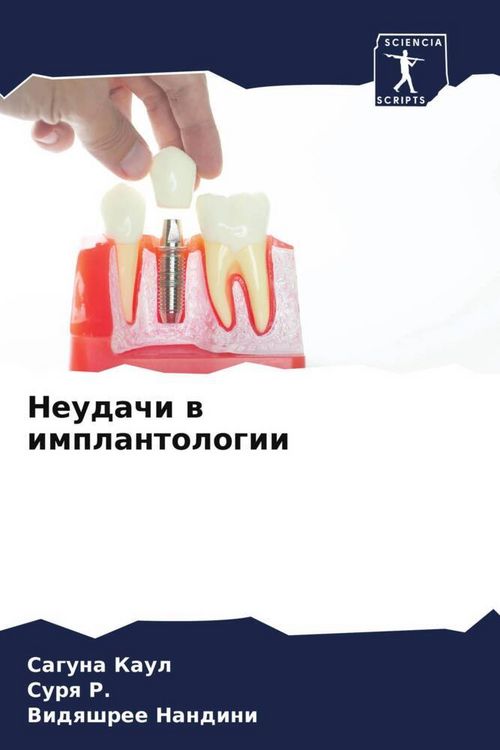 Produktbild: Neudachi w implantologii
