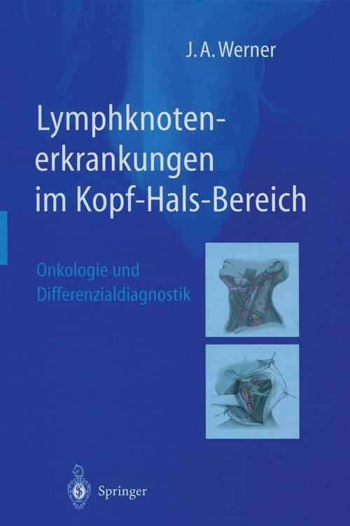 Produktbild: Lymphknotenerkrankungen im Kopf-Hals-Bereich