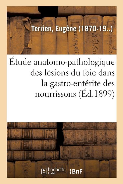 Produktbild: &Eacute;tude anatomo-pathologique des l&eacute;sions du foie dans la gastro-ent&eacute;rite des nourrissons