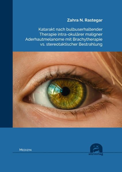 Produktbild: Katarakt nach bulbuserhaltender Therapie intra-okul&auml;rer maligner Aderhautmelanome mit Brachytherapie vs. stereotaktischer Bestrahlung