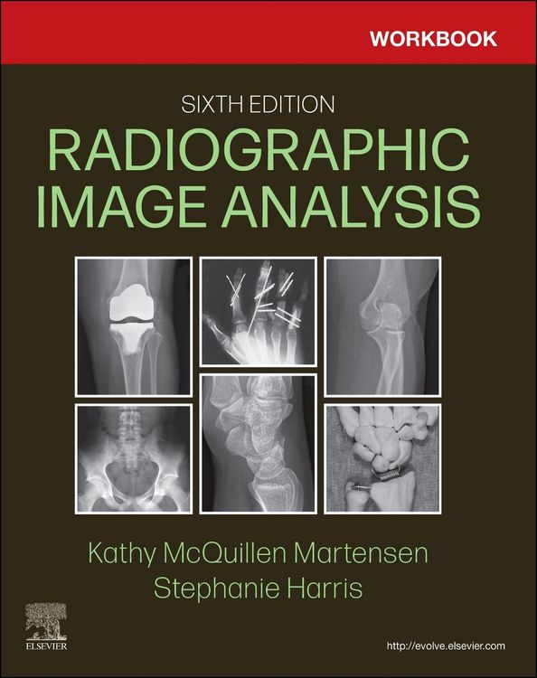 Produktbild: Workbook for Radiographic Image Analysis
