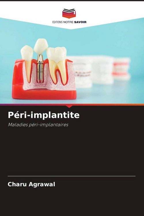 Produktbild: P&eacute;ri-implantite