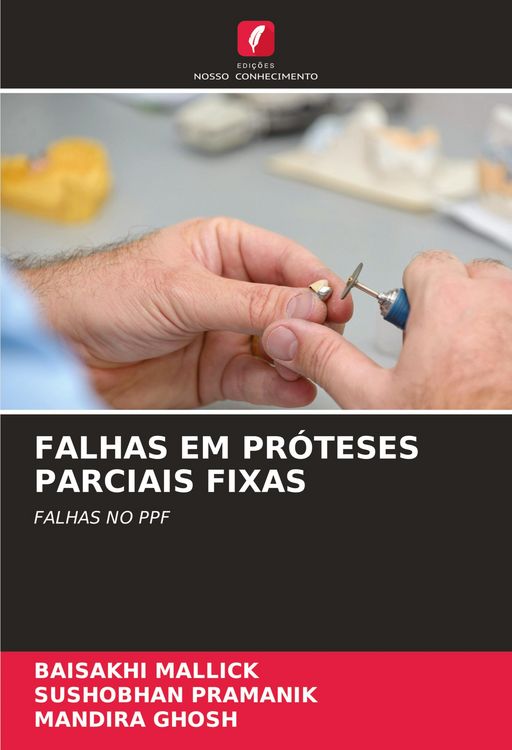 Produktbild: Falhas Em Pr&oacute;teses Parciais Fixas