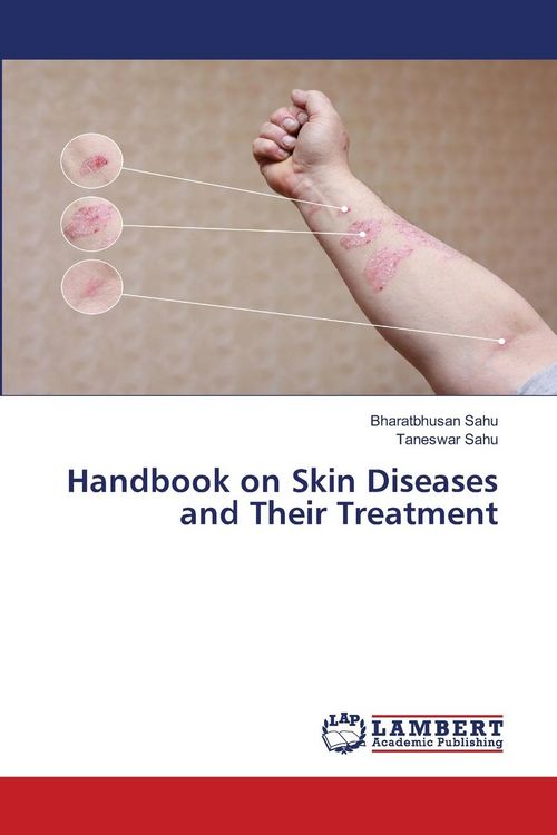 Produktbild: Handbook on Skin Diseases and Their Treatment