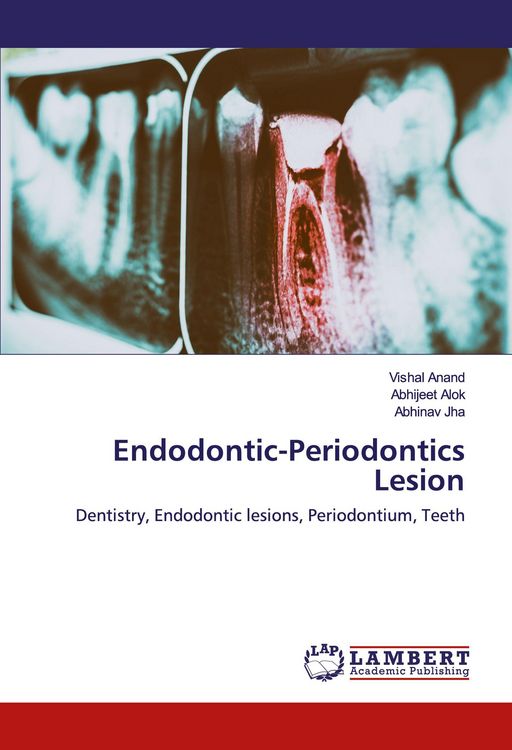 Produktbild: Endodontic-Periodontics Lesion